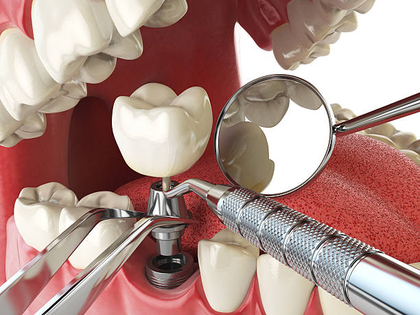 Best Emergency Gum Treatment in Portsmouth, OH