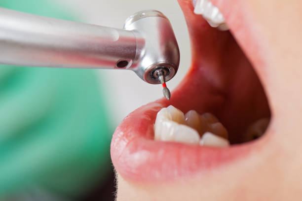 Best Emergency Treatment for Dental Infections or Abscesses in Portsmouth, OH